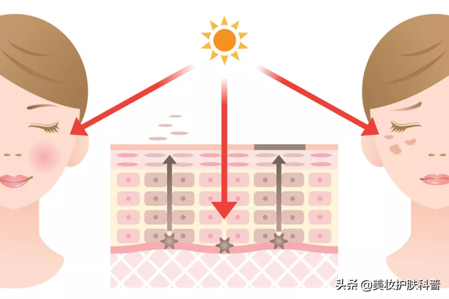 长斑前期有什么症状，长斑前期有什么症状表现（如何预防和治疗日晒斑）