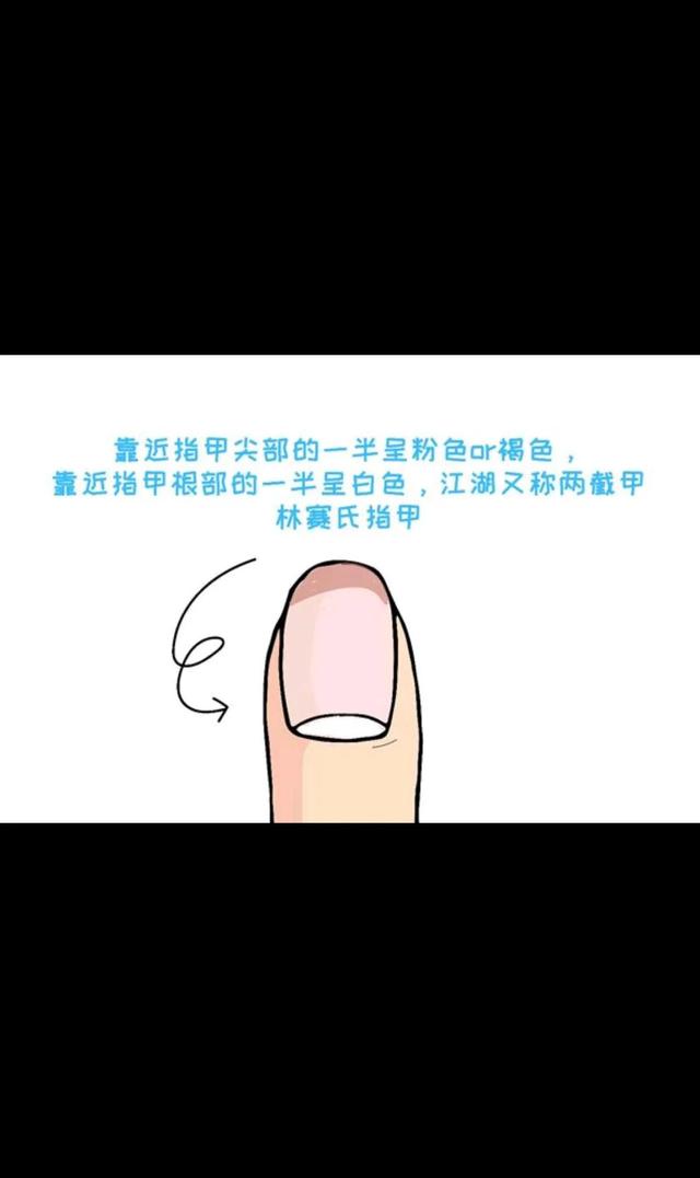 甲床是什么，生活小妙招一一养甲床