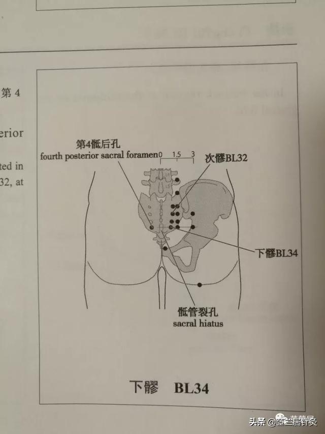 八髎准确位置图作用功效，八髎穴位位置图和作用（犹抱琵琶半遮面之八髎穴）