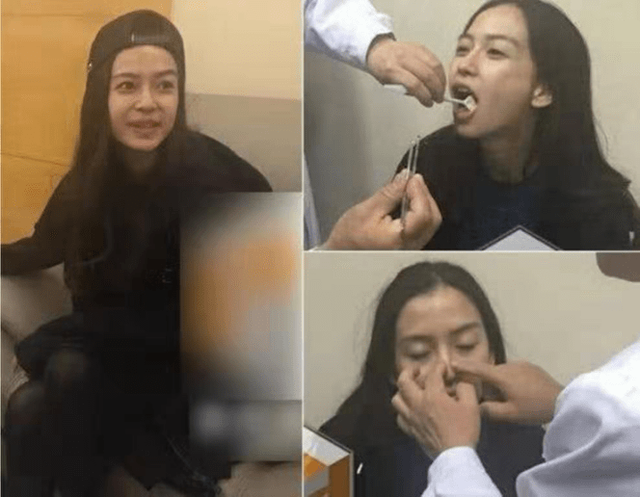 杨颖旧照曝光，烟熏眼妆黑浓太个性，曾承认戴牙套整牙