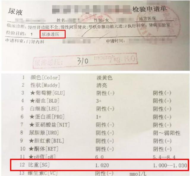 渗透压高是什么意思，蜂蜜渗透压高是什么意思（一个被忽视的肾病恶化预测指标）