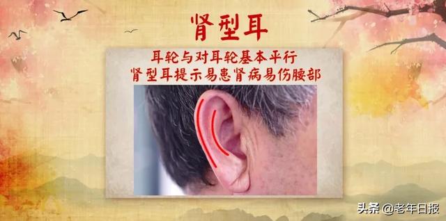 耳皮读什么意思是什么，耳朵皮读什么（降压、健脑、补肾精……别错过）