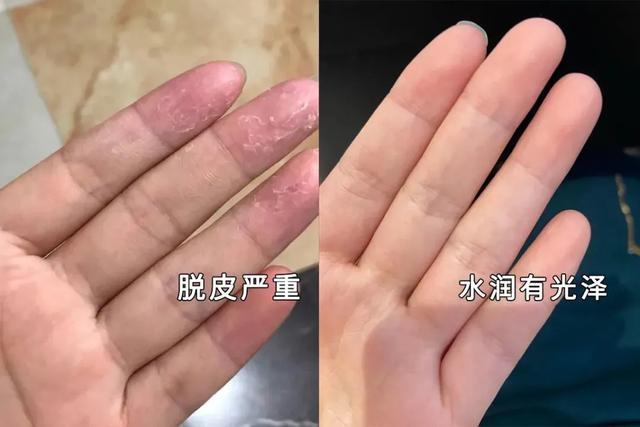 欧舒丹樱花护手霜怎么样，欧舒丹护手霜 樱桃（护手霜界的爱马仕呵护你的第二张脸）