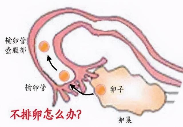 什么是无排卵性不孕，不排卵性不孕是什么意思（ 益肾调经以促孕）