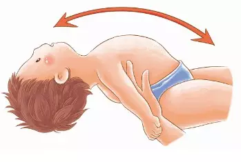 新生儿四大原始反射，拥抱反射减弱（这些反射没有处理好）