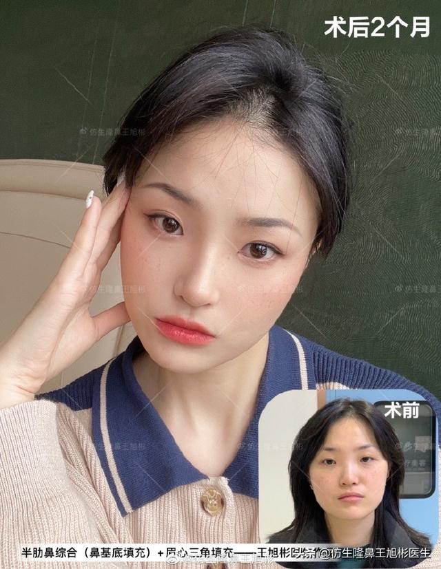 高级脸是什么意思，6种脸型不显老（“月亮脸”逆袭“高级脸”的不二法则是）