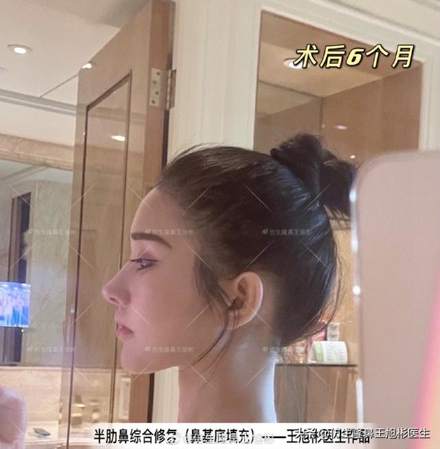 高级脸是什么意思，6种脸型不显老（“月亮脸”逆袭“高级脸”的不二法则是）