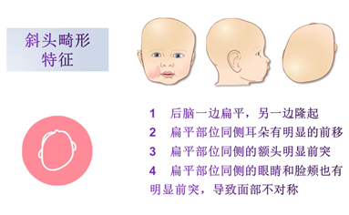 婴儿舟状头的图片，宝宝多大可以排除舟状头（婴幼儿头颅畸形）