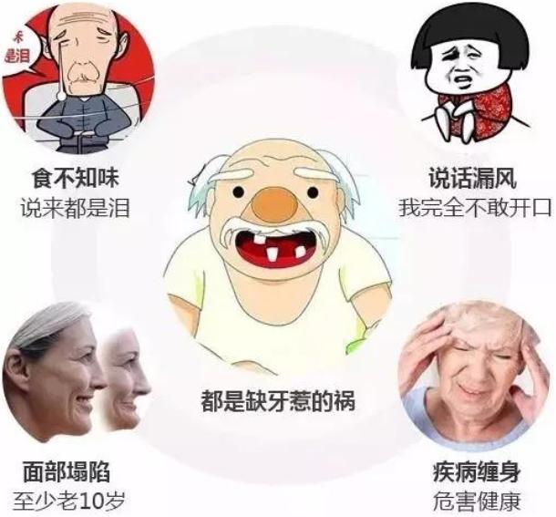 种牙好还是镶牙好，种牙与镶牙有什么区别哪个好一些（掉牙后，建议种牙还是装假牙）