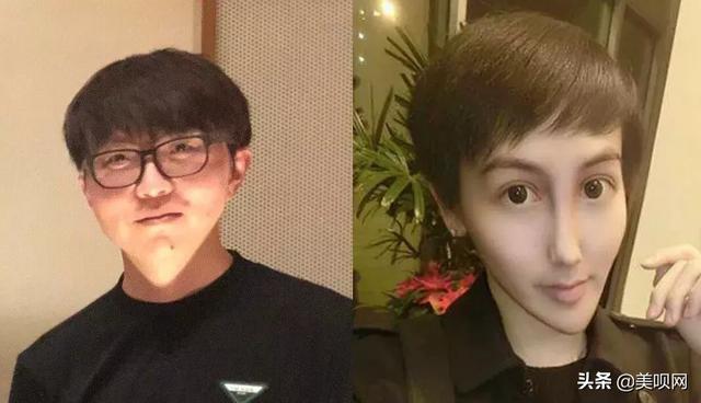 刘梓晨面部填充，日本星二代突变刘梓晨同款“蛇精脸”