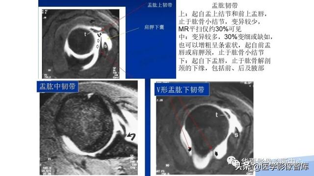 肩关节骨标志解剖图，全面掌握肩关节解剖