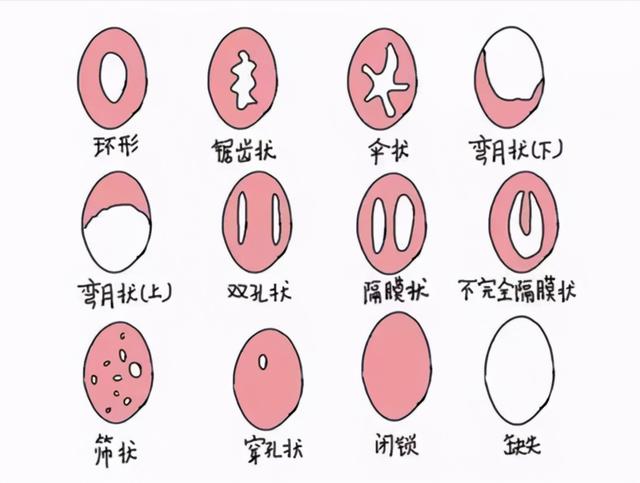 卫生棉条的用法，卫生棉条的正确使用方法（处女用卫生棉条，一定会出血）