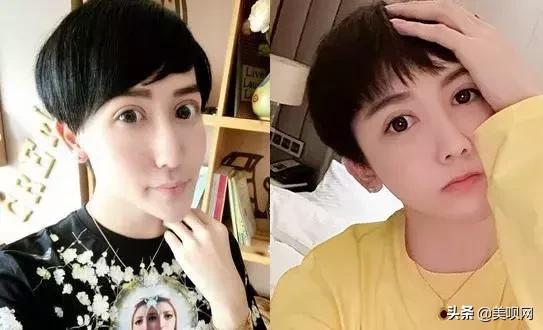 刘梓晨面部填充，日本星二代突变刘梓晨同款“蛇精脸”