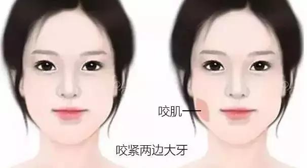 瘦脸针品牌十大排行榜，瘦脸针品牌排行榜（瘦脸针能维持多久）