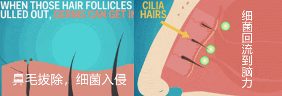 鼻毛长怎么办，鼻头长毛是怎么回事（多数人都剪掉或者拔掉）
