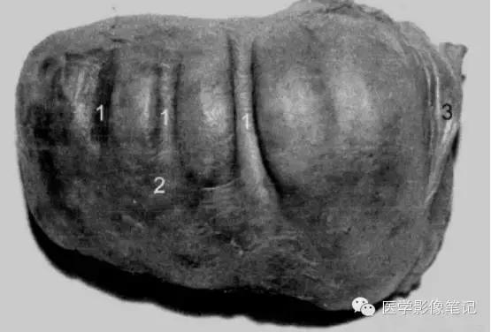 吃赖尿虾的好处，孕妇可以吃濑尿虾吗中期（这8种肝脏变异）