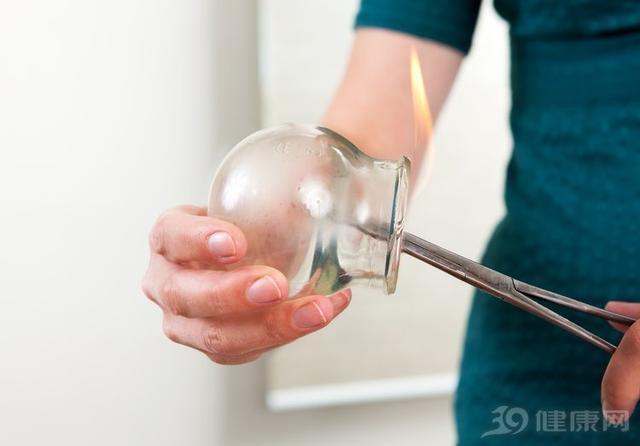 拔罐可以去湿气吗，拔罐的好处与功效（不过有一类人不适合）