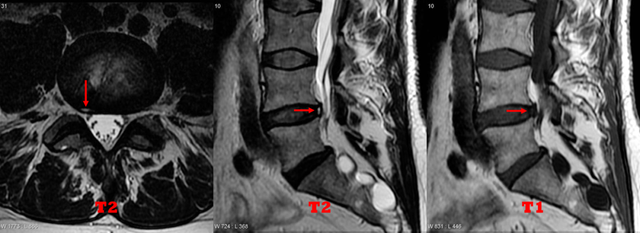 医学名词解释，医学名词解释app（医学名词—HIZ）