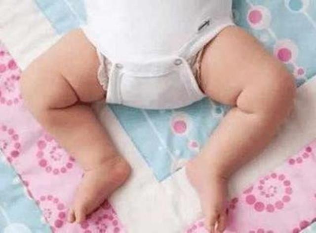 腿弯怎么办，会是“罗圈腿”吗（10岁孩子腿弯怎么办）