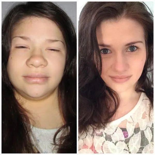 脸肿是什么原因引起的，半边脸肿是什么原因引起的（为什么早上脸会变肿）