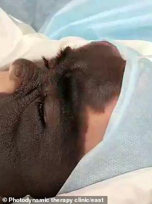 光敏印章怎么加油，原子公章和光敏章的区别（萌娃因“蝙蝠侠”胎记遭网暴）