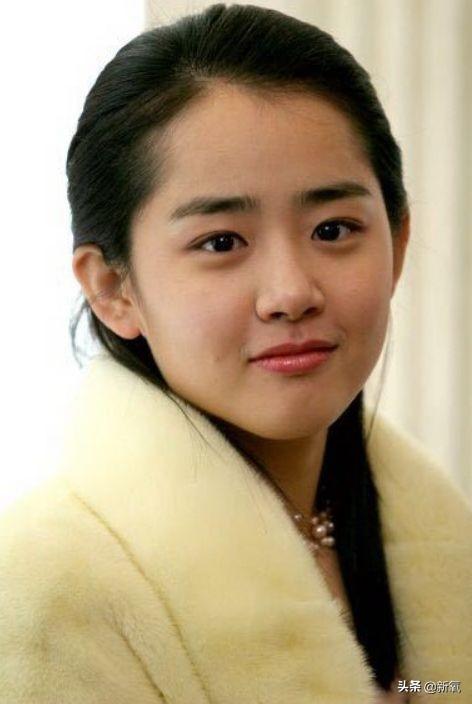 发际线粉会堵塞毛孔吗，发际线粉的危害（关晓彤才23岁就秃了）