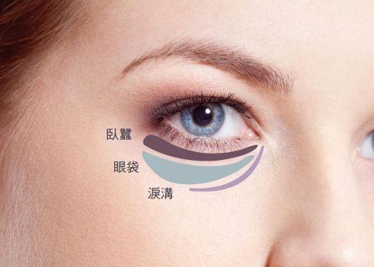 眼袋下面的纹是什么纹，为什么眼睛下面有眼袋纹（你又知道这黑三角是哪吗）