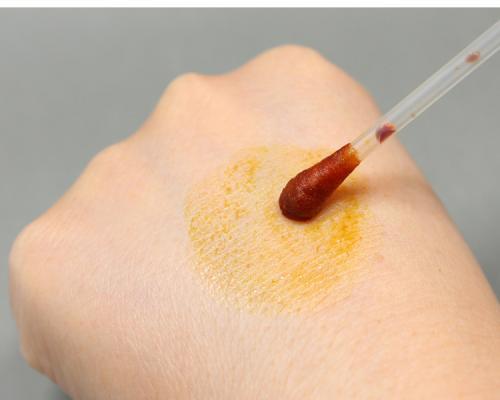 络合碘和碘伏的区别，碘伏与碘酒的区别是在哪方面（这个关于碘伏的冷知识）