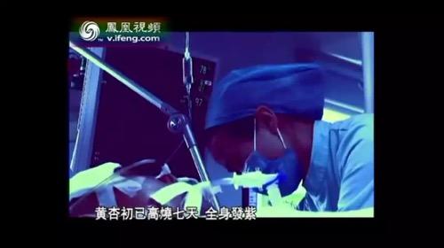 非典的真实事件，2003年那场让人胆寒的非典