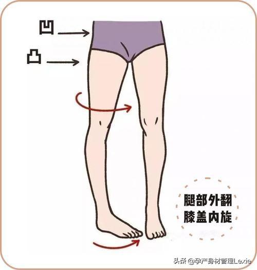 生完孩子假胯宽怎么办，生孩子后假胯宽怎么矫正（都是“假胯宽”惹的祸）