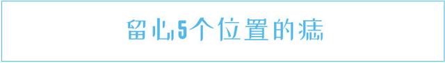 长在身体不同地方的痣，代表什么含义，长在身体不同地方的痣（痣也不好惹：藏在5个地方的痣）