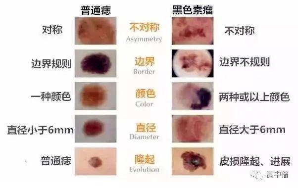 跳眼法时辰测吉凶，跳眼法吉凶预兆（竟然还有科学依据）