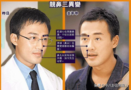 傅明宪双眼皮是割的，傅明宪（但这5位演员“换头逆袭”）