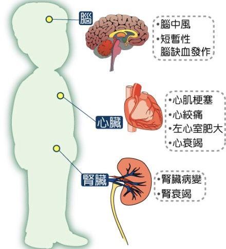 高血压160/110危险吗，高血压160/110危险吗吃什么药（50岁的人高压160）