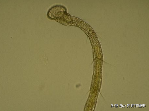 微生物镜检标准是多少，污水处理厂微生物镜检流程与污泥活性分析总结