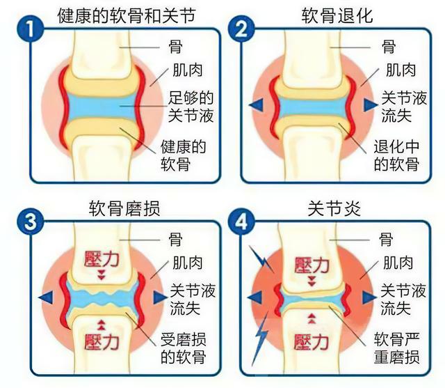 正确坐着睡觉的姿势，站着睡觉姿势（调整坐、站、行、跑、睡五种姿势）