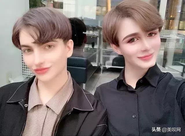 刘梓晨面部填充，日本星二代突变刘梓晨同款“蛇精脸”