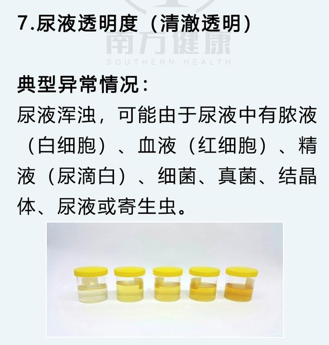 尿常规怎么检查，男性尿常规怎么看（5分钟判断身体健康）