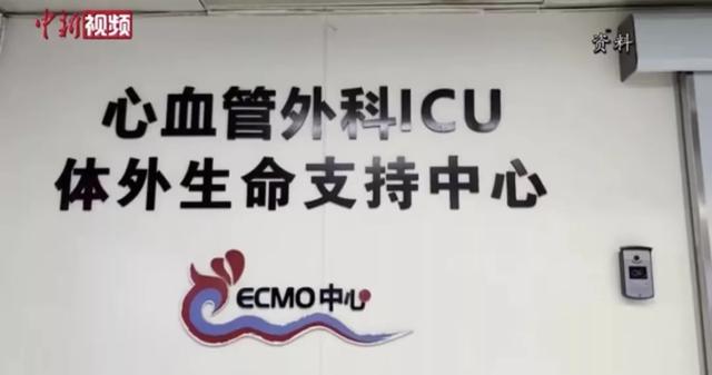 中国国产ecmo进入临床阶段，国内多少医院能做ECMO（国产ECMO进入临床阶段）