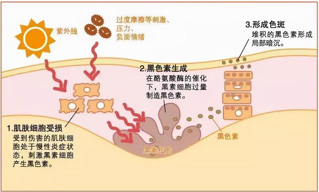 消除皱纹的10个最好最简单方法，消除皱纹的10个最简单方法（消除的最简单的方法是什么）