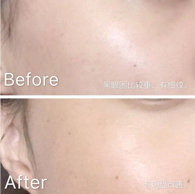 兰蔻眼霜生产日期怎么看生产日期，兰蔻面霜哪里看生产日期（无论你现在20、30还是40岁）