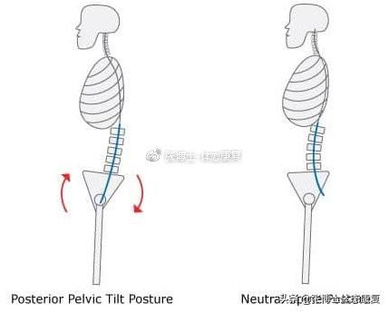 盆骨倾斜要怎么调整才弄得回来，产后盆骨前倾要怎么调整才弄得回来（骨盆后倾的形成原因与矫正训练）