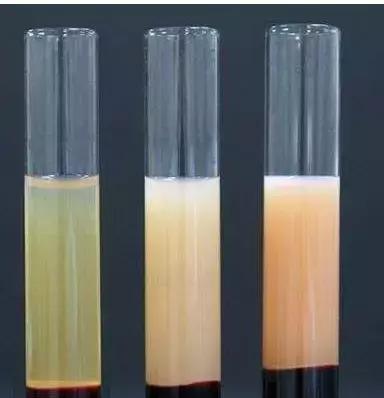 LDL-C、HDL-C、TG傻傻分不清？