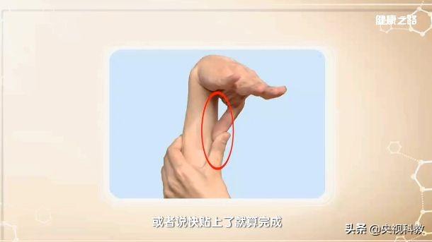 小拇指外翻怎么矫正，让你又丑又疼的拇外翻矫正方法在这里