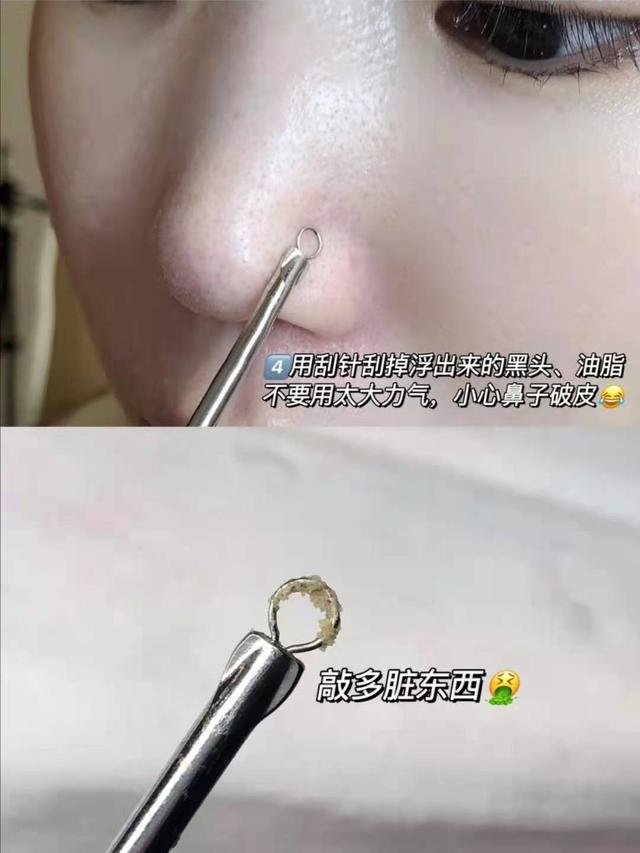 去黑头收缩毛孔，怎样去黑头和收缩毛孔（去黑头收缩毛孔的最好方法）