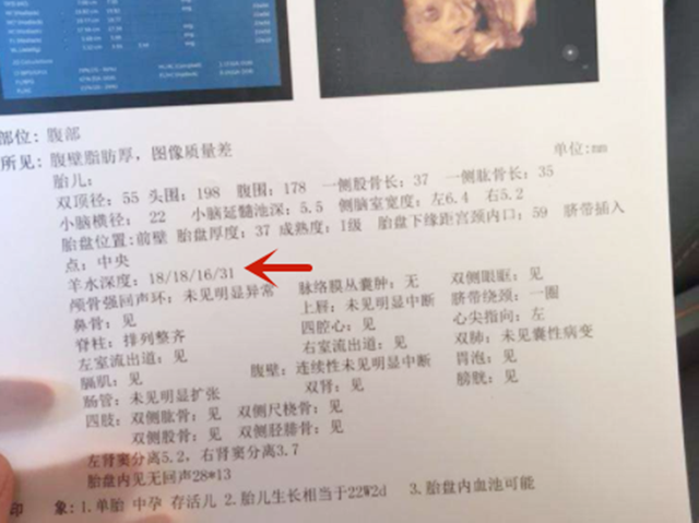 怎么看b超单，怎么看b超单子,算小孩体重（暗藏胎儿的“小秘密”）