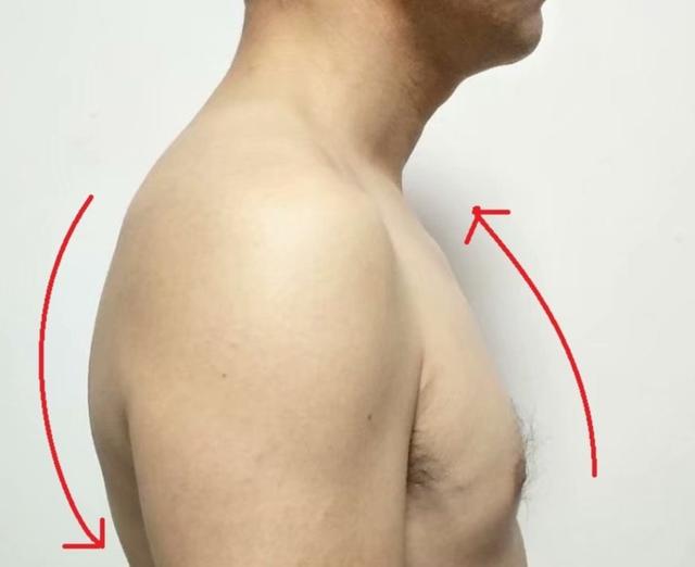 溜肩怎么练成平肩，男生溜肩怎么练成平肩（上斜方肌受着不可承受之重。选对方法）