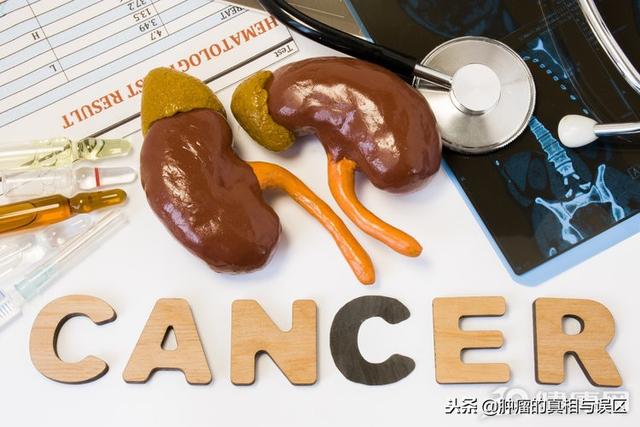 癌症晚期怎么办，肿瘤化疗费用一般多少钱（3件事都做到，你也算是尽力了）