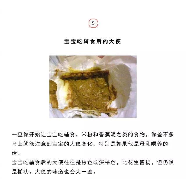 婴儿大便颜色常识图解，婴儿大便颜色常识图解5月龄宝宝大便次数（易引起不适>劝你做好心理准备再看）