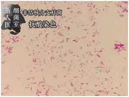 溶脂针瘦腿有什么危害，溶脂针瘦腿有什么危害吗（28岁女子打“瘦腿针”后险遭截肢）